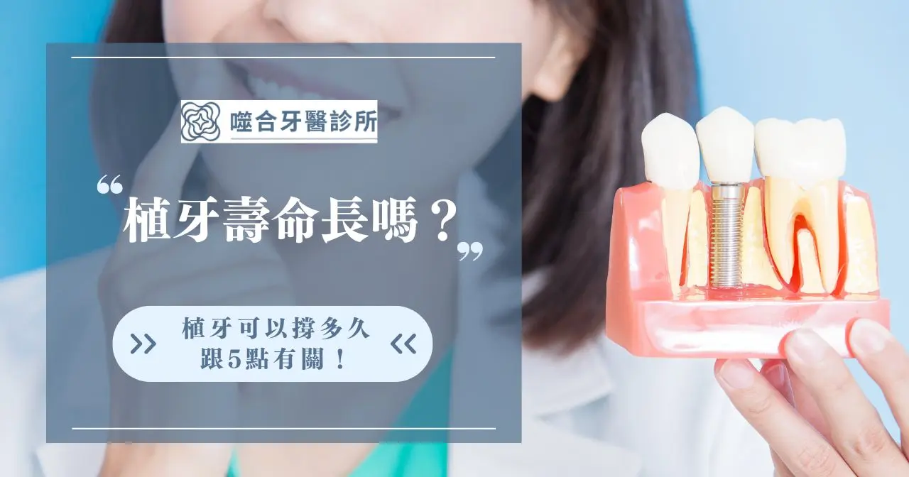 植牙壽命長嗎？植牙可以撐多久跟5點有關！