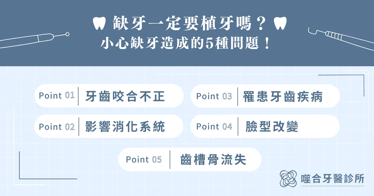 缺牙一定要植牙嗎？小心缺牙造成的 5 種問題！