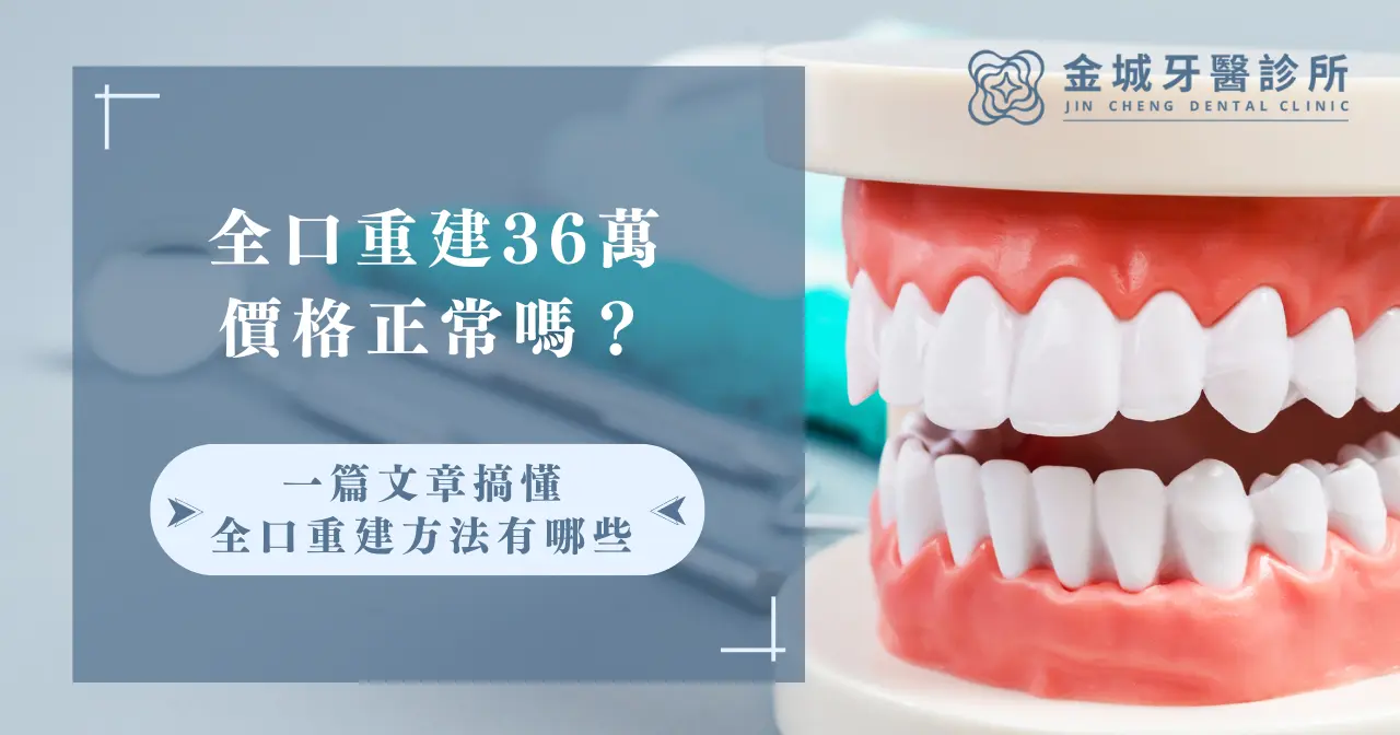 全口重建36萬價格正常嗎？一篇文章搞懂全口重建方法有哪些！