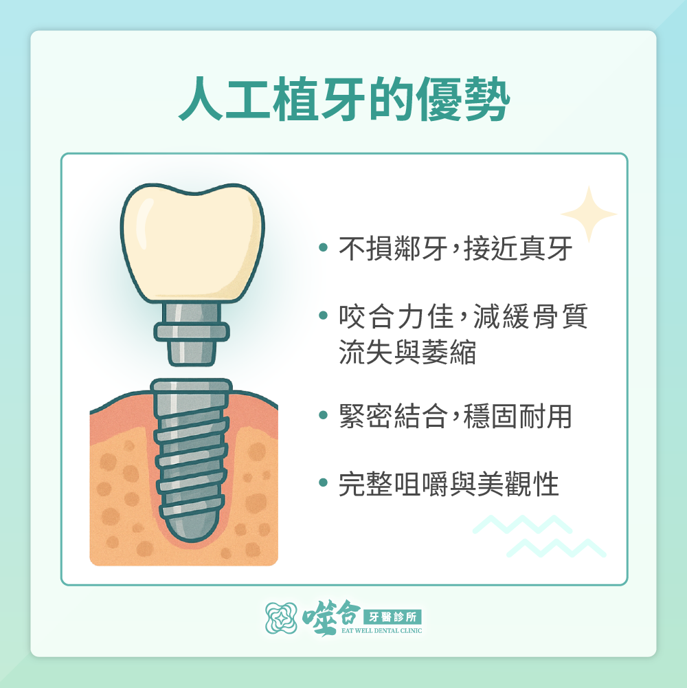 人工植牙的優勢有哪些