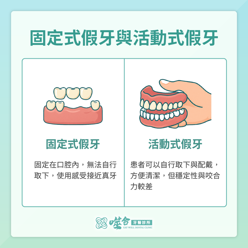 固定式假牙與活動式假牙的差異