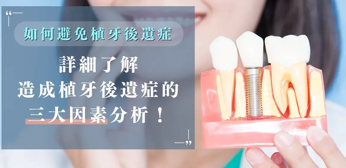 如何避免植牙後遺症｜詳細了解造成植牙後遺症的三大因素分析！